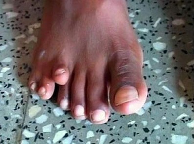 090223toes.jpg
